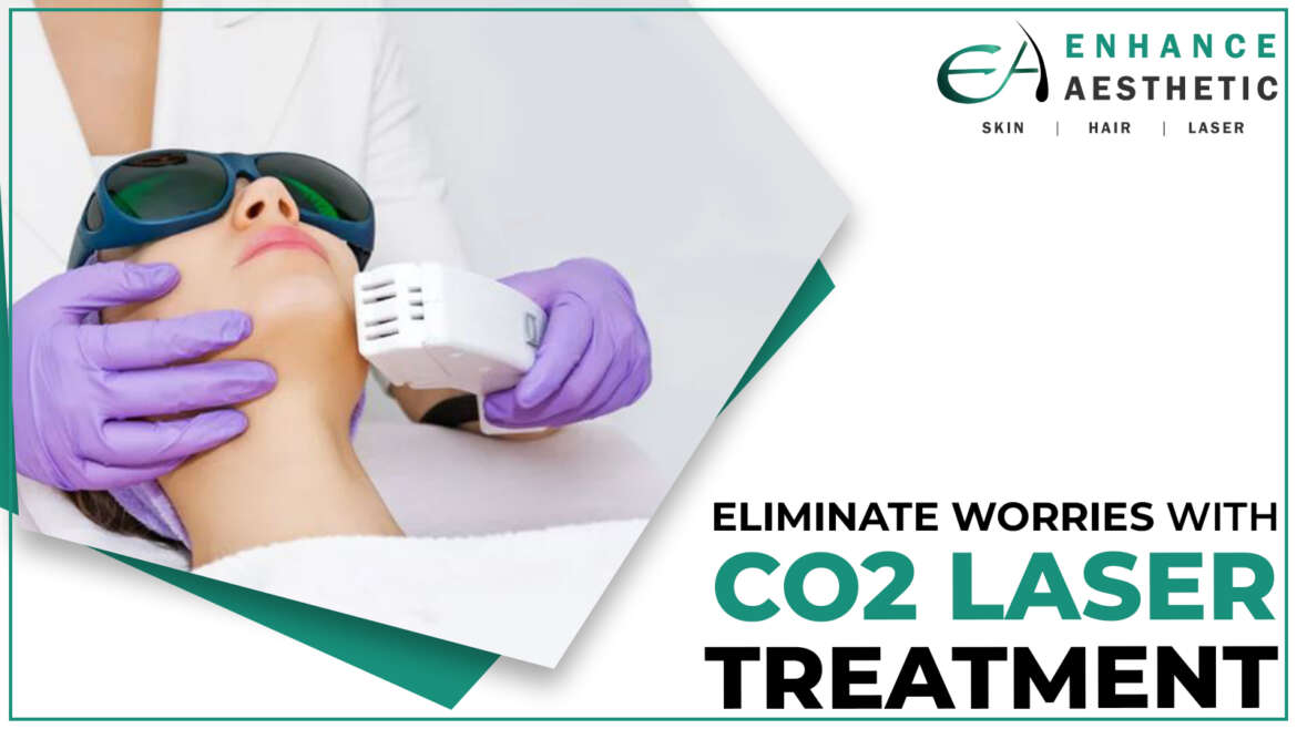 CO2 laser