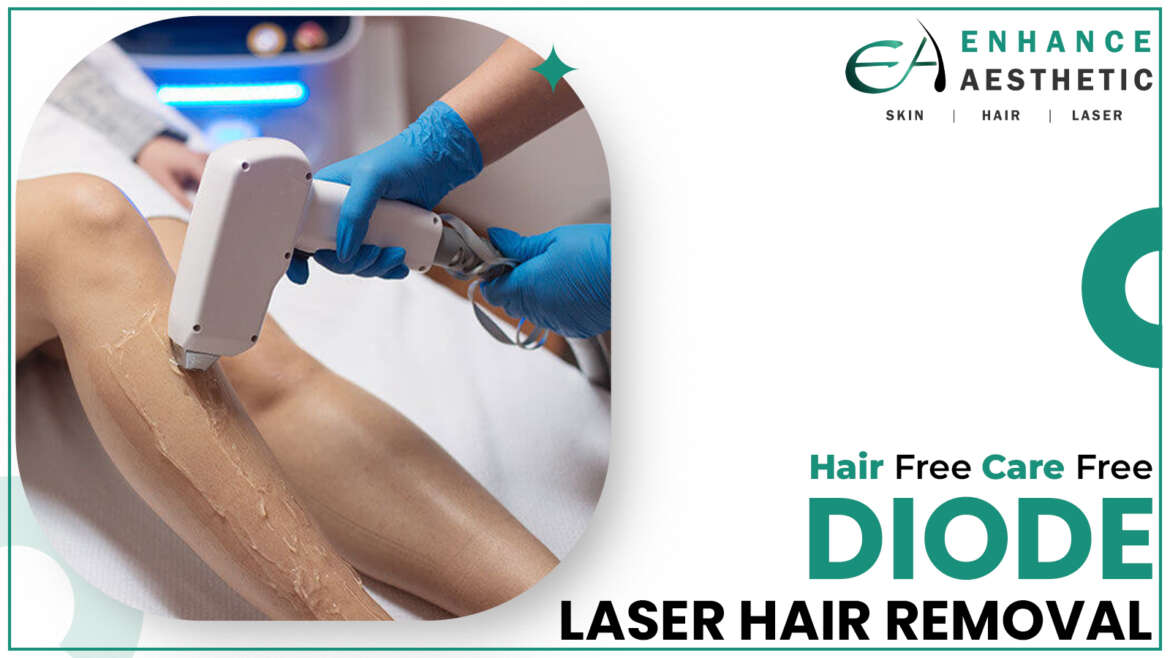 Laser Hair Removal