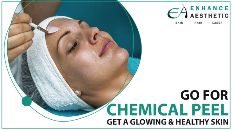 Chemical Peel