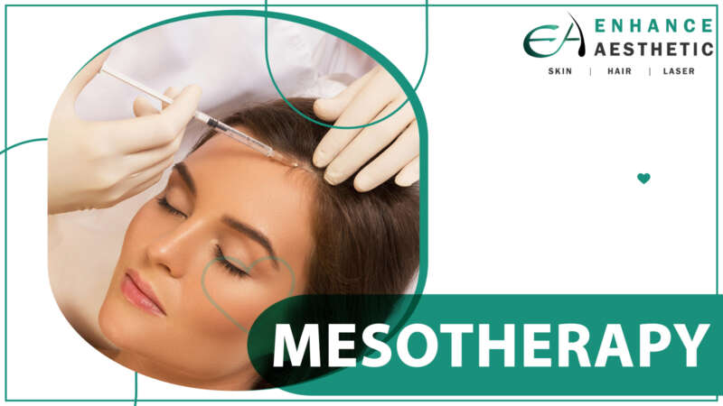 Mesotherapy in Kharadi, Hadapsar, Pune at Enhance Aesthetic clinic
