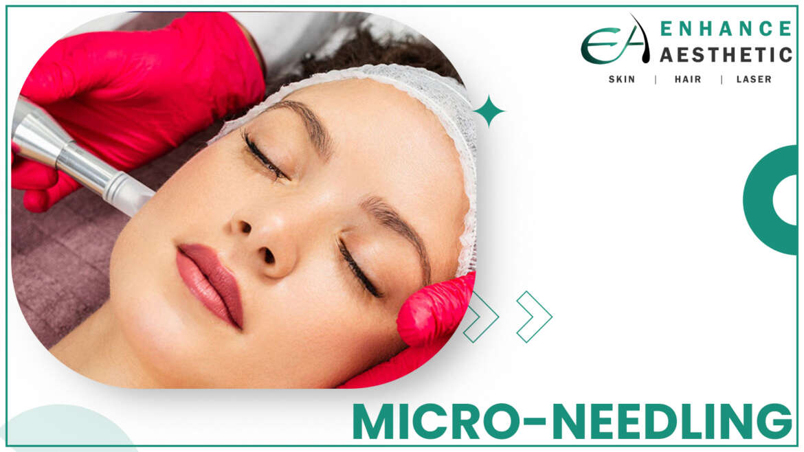 Micro-needling