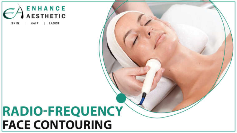 RF Face Contouring