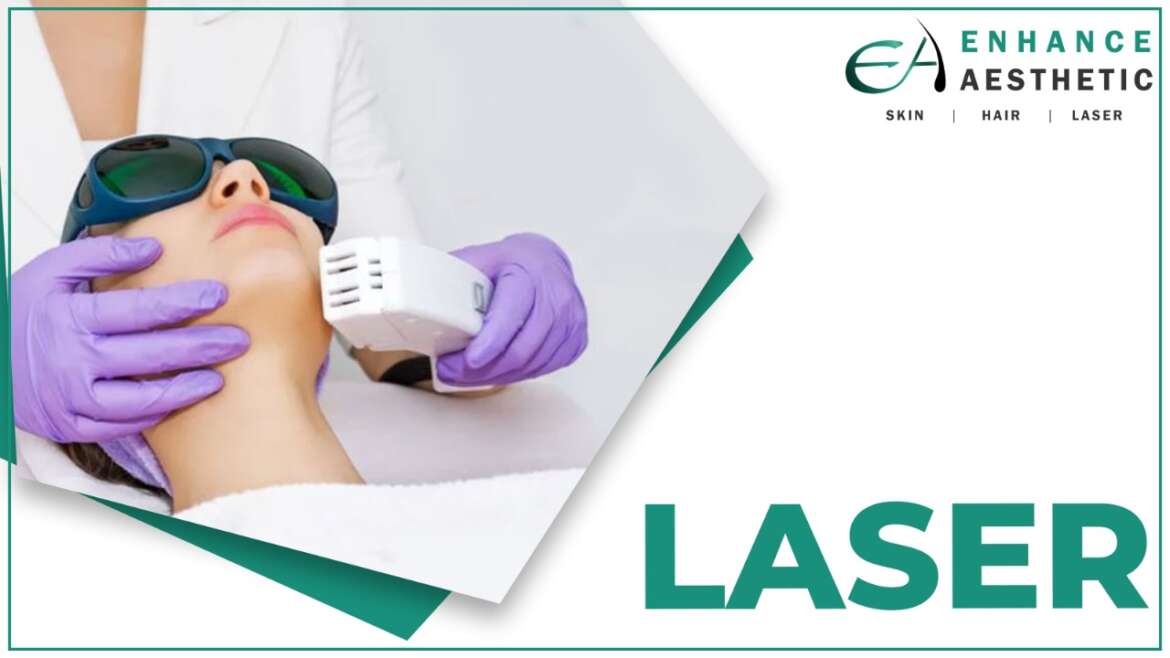 Laser Treatments