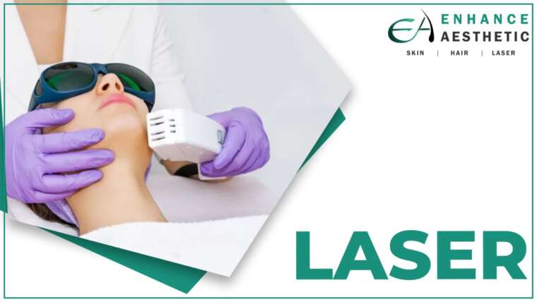 Laser Treatments