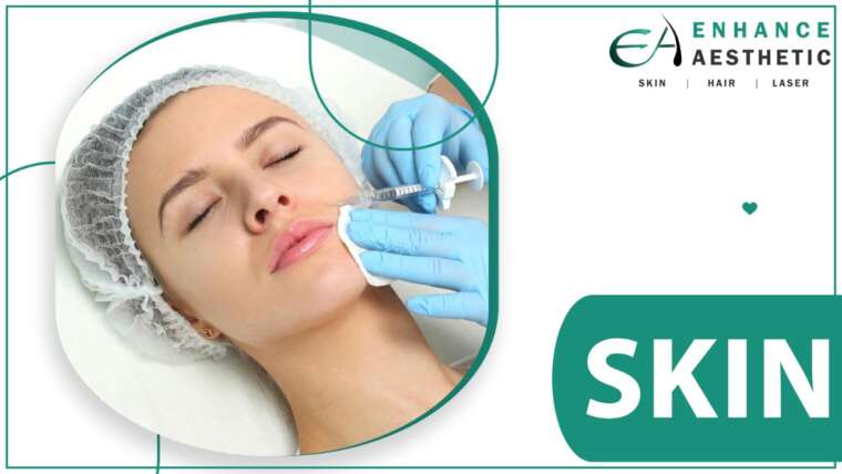 Skin Treatments