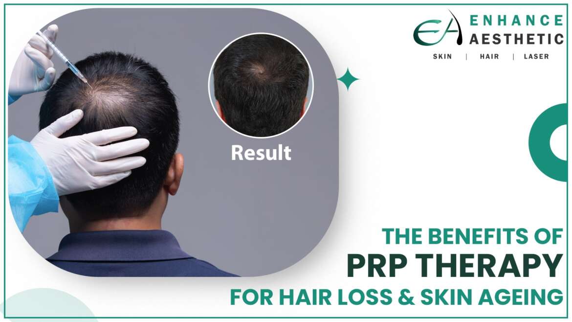 The Benefits of PRP Therapy for Hair Loss & Skin Ageing
