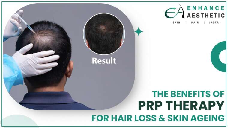 The Benefits of PRP Therapy for Hair Loss & Skin Ageing