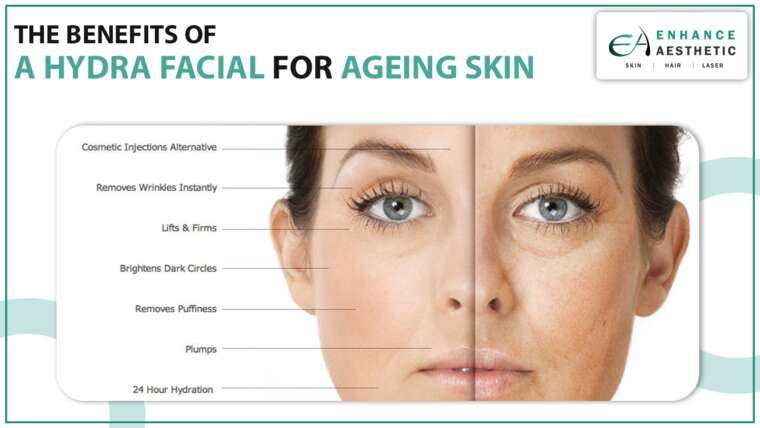 <strong>The Benefits of a Hydra Facial for Ageing skin</strong>