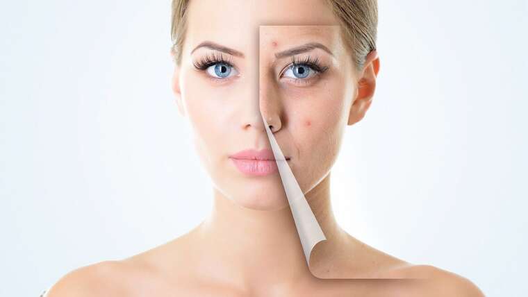 Are Skin Issues Affecting Your Self-esteem? Explore the Benefits of Skin Treatments