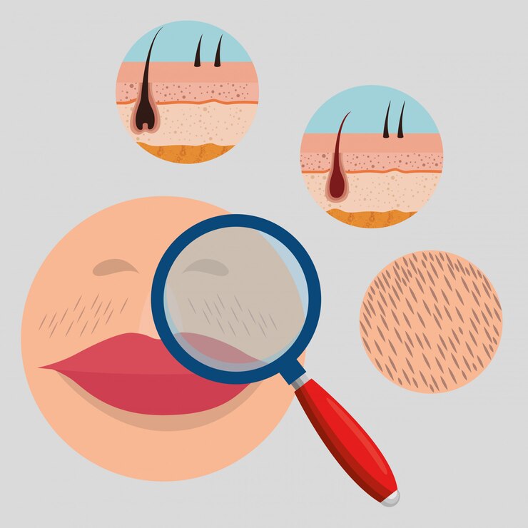 Understanding Hirsutism: Causes And Treatments